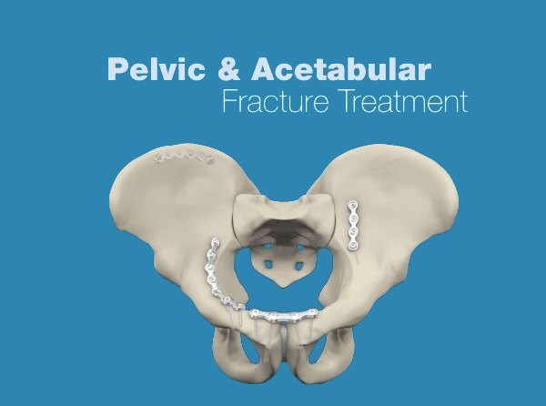 Pelvic & Acetabular Trauma