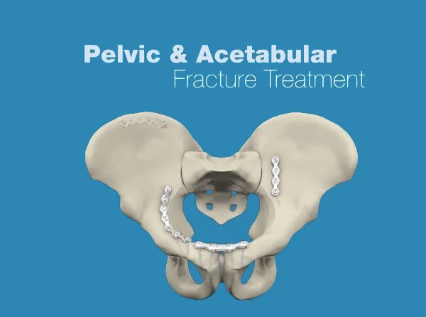 Pelvic & Acetabular Trauma