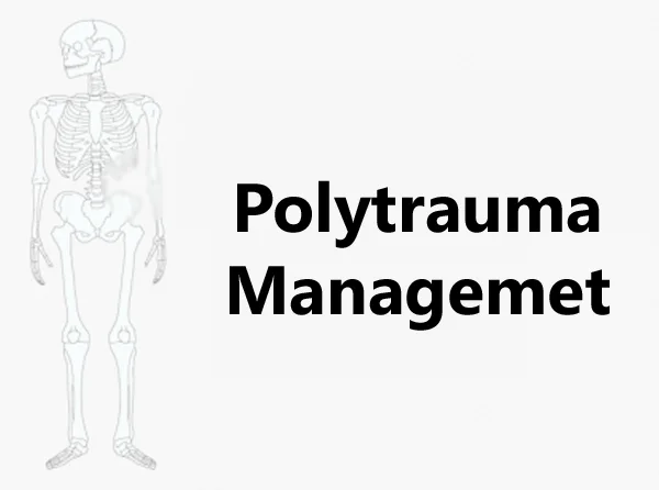 Polytrauma Management